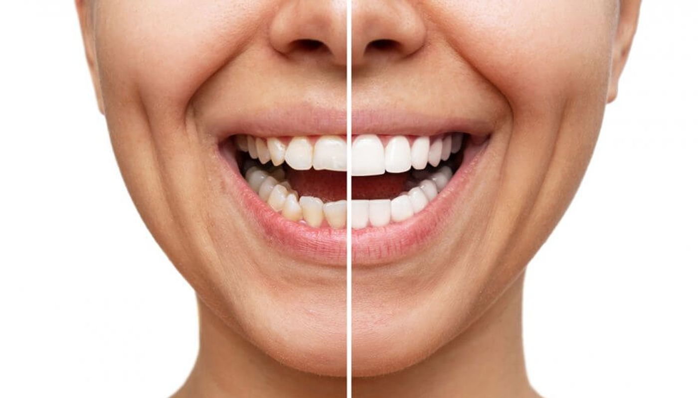 Odontoiatria conservativa